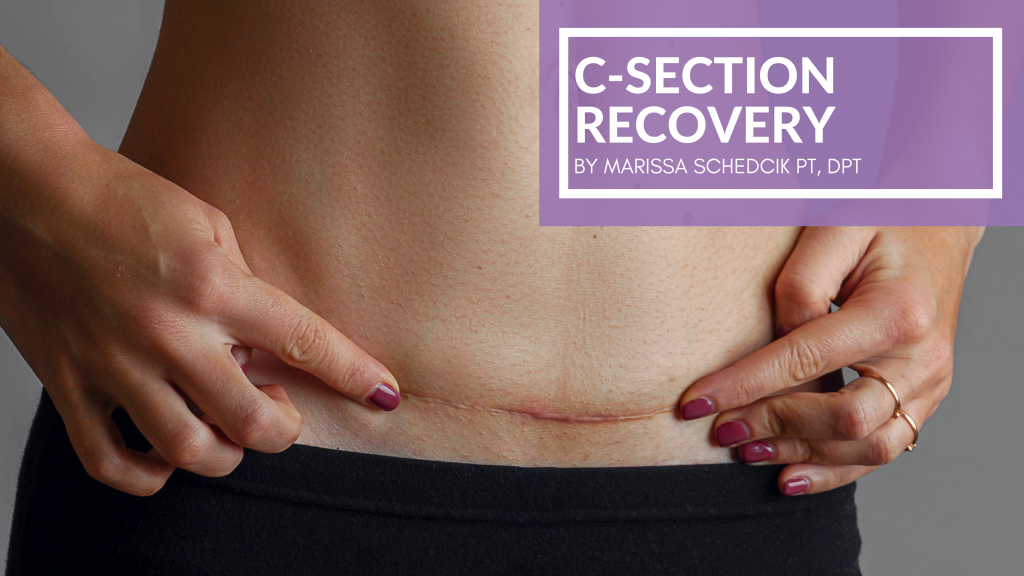 C-Section Recovery - Woerner Physical Therapy